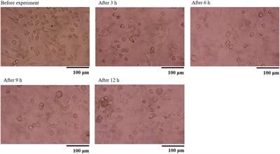 Culture System for a Closer Biological Contact Between Macrophages and Microparticles